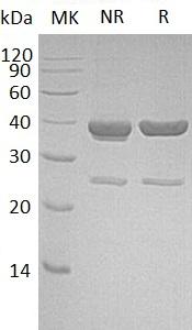 Human AKR1C4/CHDR (His tag) recombinant protein