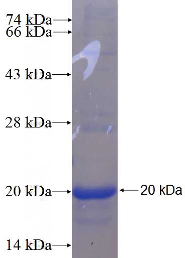 Recombinant Human FCRL5 SDS-PAGE