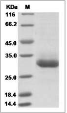 Human RAB11B Protein (His Tag)