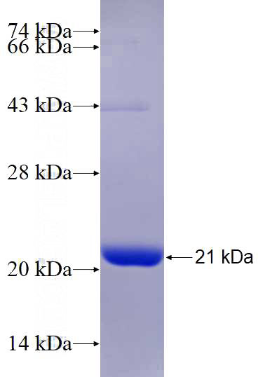 Recombinant Human POMP SDS-PAGE