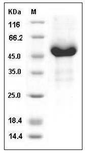 Human GFRA3 / GFR-alpha-3 Protein (His Tag) SDS-PAGE