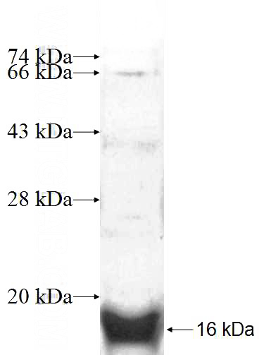 Recombinant Human ADAT2 SDS-PAGE