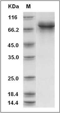 Canine Carbonic Anhydrase IX / CA9 Protein (Fc Tag) SDS-PAGE