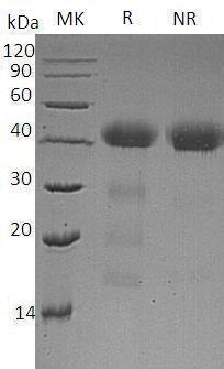 Human AZGP1/ZAG/ZNGP1 (His tag) recombinant protein