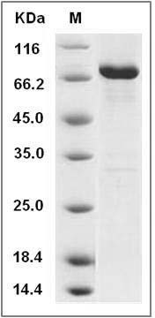 Human DDR2 Kinase / CD167b Protein (aa 422-855, His & GST Tag) SDS-PAGE