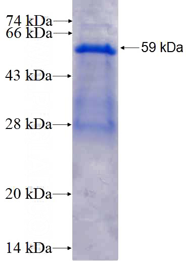 Recombinant Human TRAF4 SDS-PAGE
