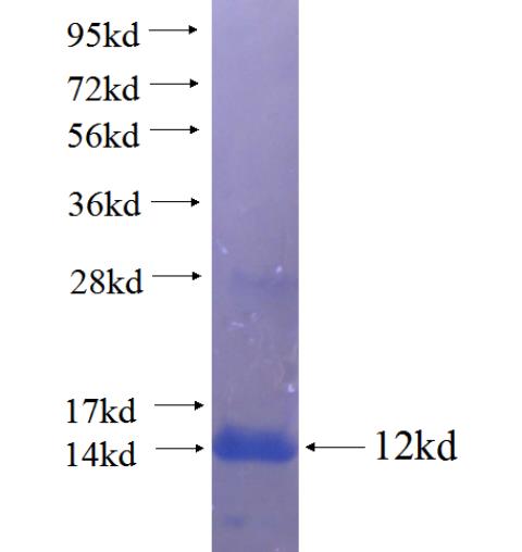 Recombinant human GABRR1 SDS-PAGE