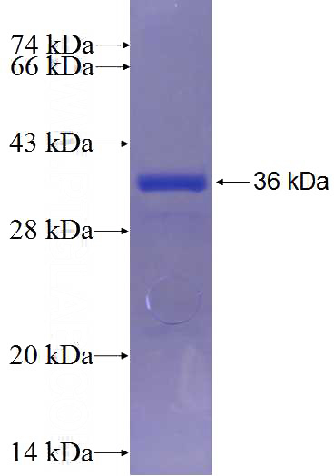 Recombinant Human ODF3L1 SDS-PAGE