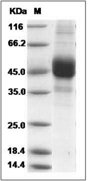 Human CD3d / CD3 delta Protein (Fc & FLAG Tag) SDS-PAGE