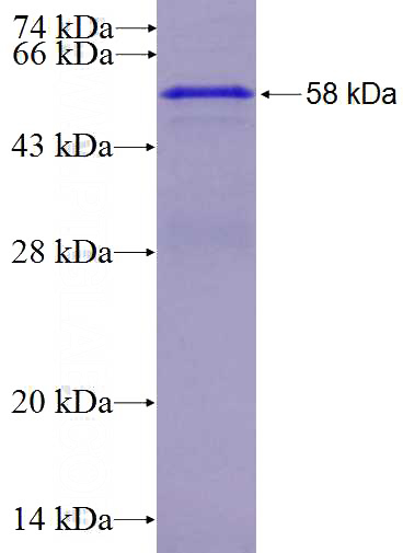 Recombinant Human CDH11 SDS-PAGE