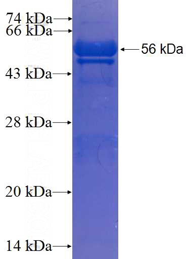 Recombinant Human C9orf24 SDS-PAGE