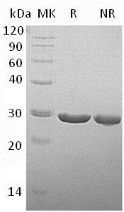 Human TPK1 (His tag) recombinant protein