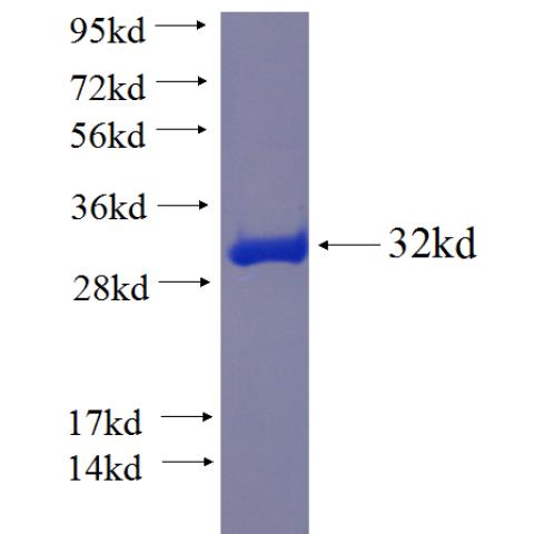 Recombinant human FAM78B SDS-PAGE