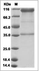 Human EphA1 / Eph Receptor A1 Protein (Fc Tag)