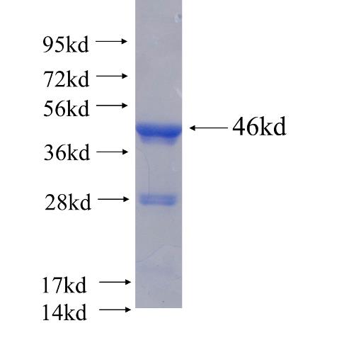 Recombinant human TRAPPC3(Full length) SDS-PAGE