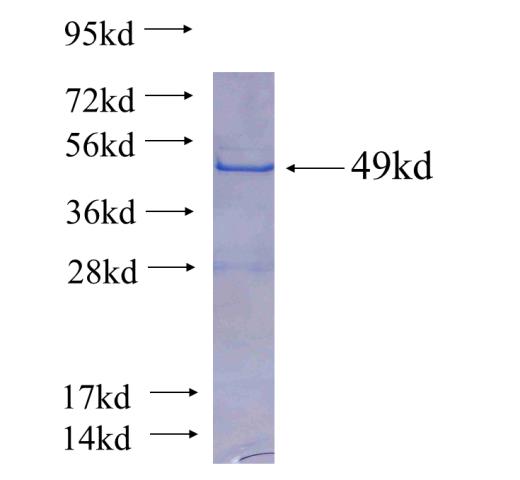 Recombinant human CLTB(Full length) SDS-PAGE