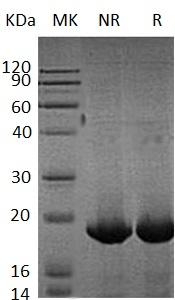 Human UPP1 (His tag) recombinant protein