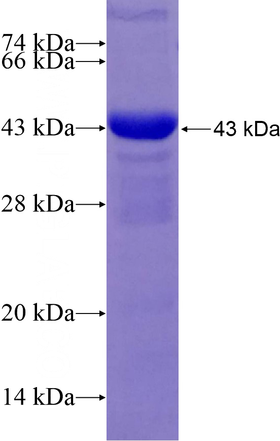 Recombinant Human ZER1 SDS-PAGE
