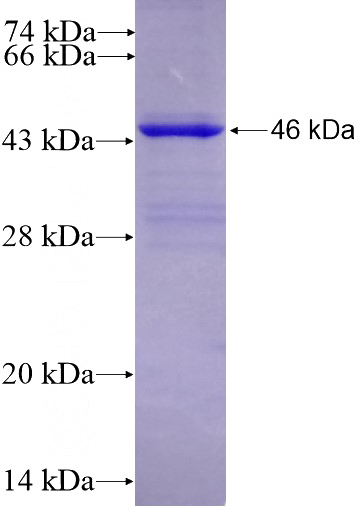 Recombinant Human CYP51A1 SDS-PAGE