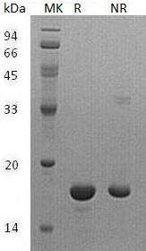 Human EIF4EBP1 (His tag) recombinant protein
