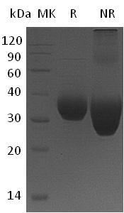 Human BTN1A1/BTN (His tag) recombinant protein