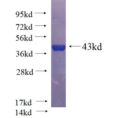 Recombinant mouse Il1b SDS-PAGE