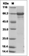 Human PELI1 / Pellino-1 Protein (His & GST Tag) SDS-PAGE