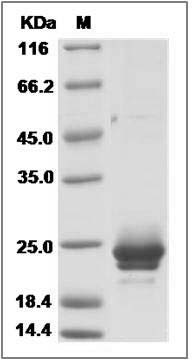 Mouse IFNA5 / IFNaG Protein (His Tag) SDS-PAGE