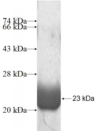 Recombinant Human GPR180 SDS-PAGE