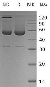 Human SERPINH1/CBP1/CBP2/HSP47 (His tag) recombinant protein