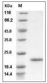 Human CD16b / FCGR3B Protein SDS-PAGE
