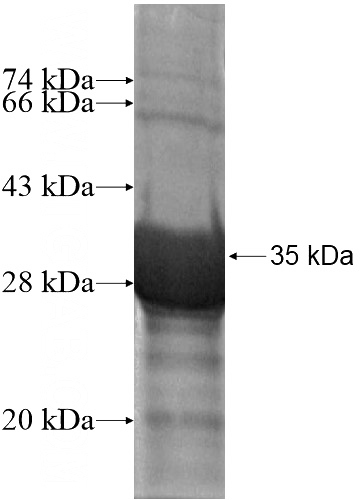 Recombinant Human POMT2 SDS-PAGE