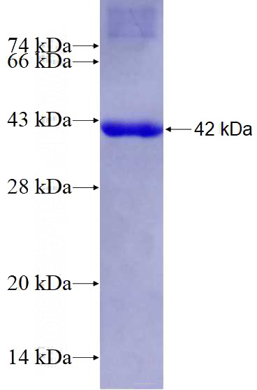 Recombinant Human ATP1A1 SDS-PAGE