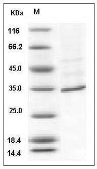 Human FANCA / FACA Protein (His Tag) SDS-PAGE
