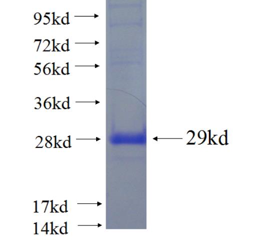 Recombinant human COMMD7 SDS-PAGE