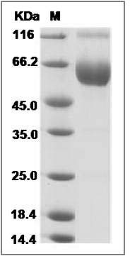 Rat PD1 / PDCD1 Protein (Fc Tag) SDS-PAGE