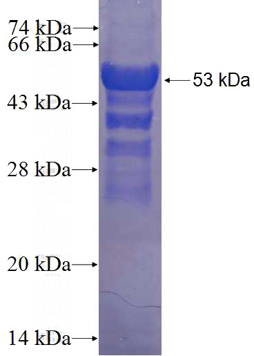 Recombinant Human TTLL10 SDS-PAGE