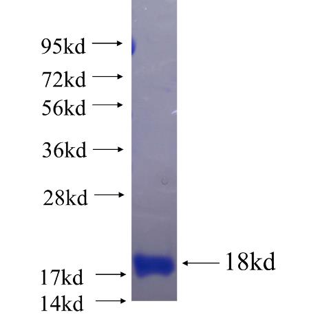 Recombinant human C2orf44 SDS-PAGE