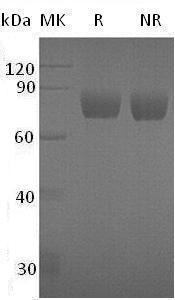 Mouse Serpind1/Hcf2/Hcii (His tag) recombinant protein