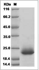 Human Glycoprotein Xg / PBDX Protein (His Tag) SDS-PAGE
