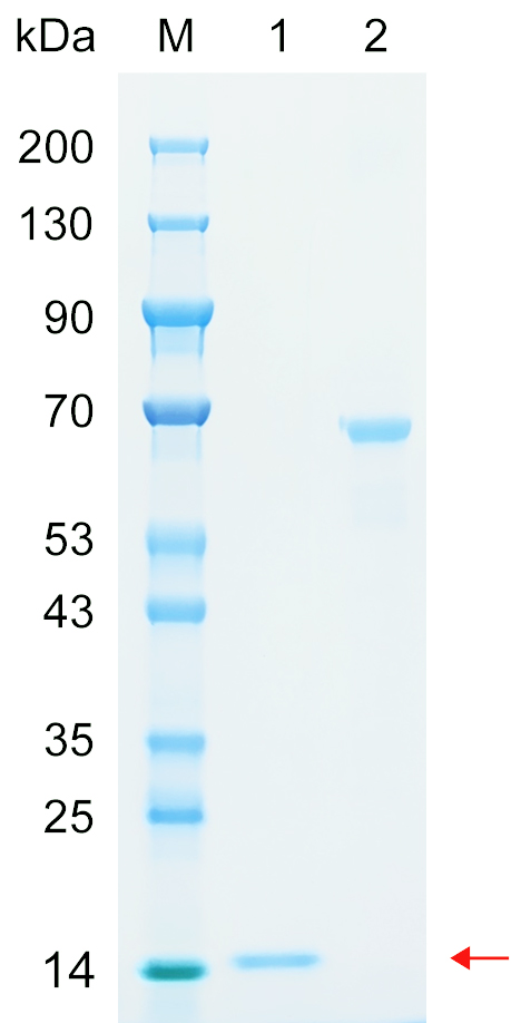 Recombinant FCMR protein (His tag) SDS-PAGE