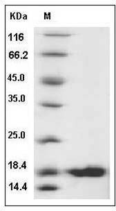 Human UBCH8 / UBE2L6 Protein (His Tag) SDS-PAGE