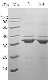 Human TPM3 recombinant protein