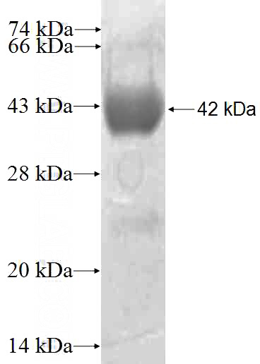 Recombinant Human ALDH1B1 SDS-PAGE
