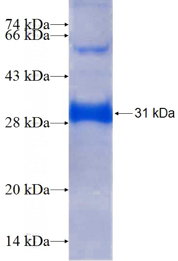 Recombinant Human PPM1J SDS-PAGE