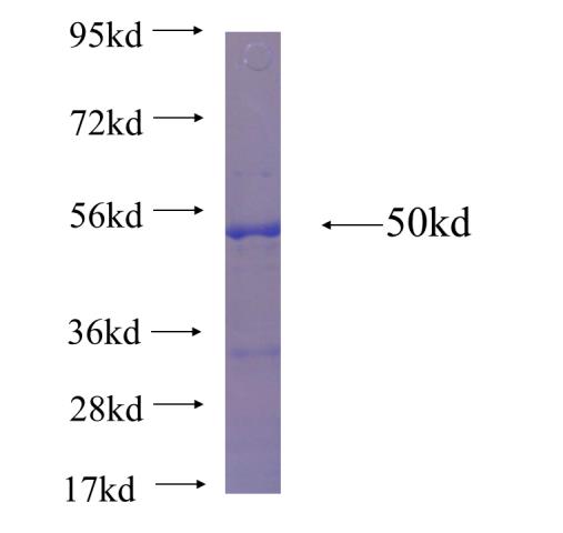 Recombinant human MTHFD1 SDS-PAGE