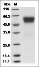 Human sFRP4 Protein (His Tag) SDS-PAGE