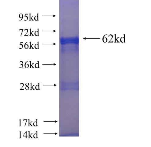 Recombinant human MLST8 SDS-PAGE