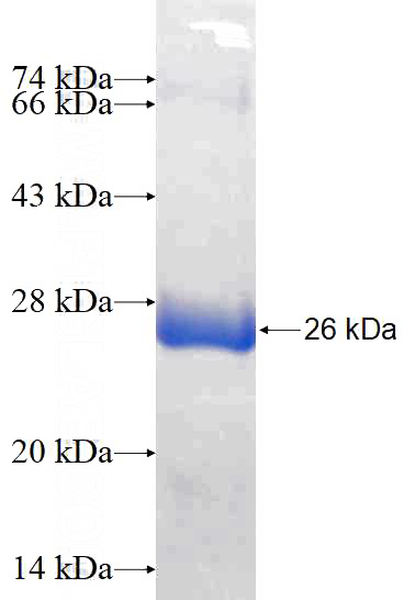 Recombinant Human C11orf73 SDS-PAGE