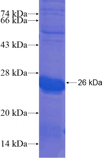 Recombinant Human ANKRD39 SDS-PAGE